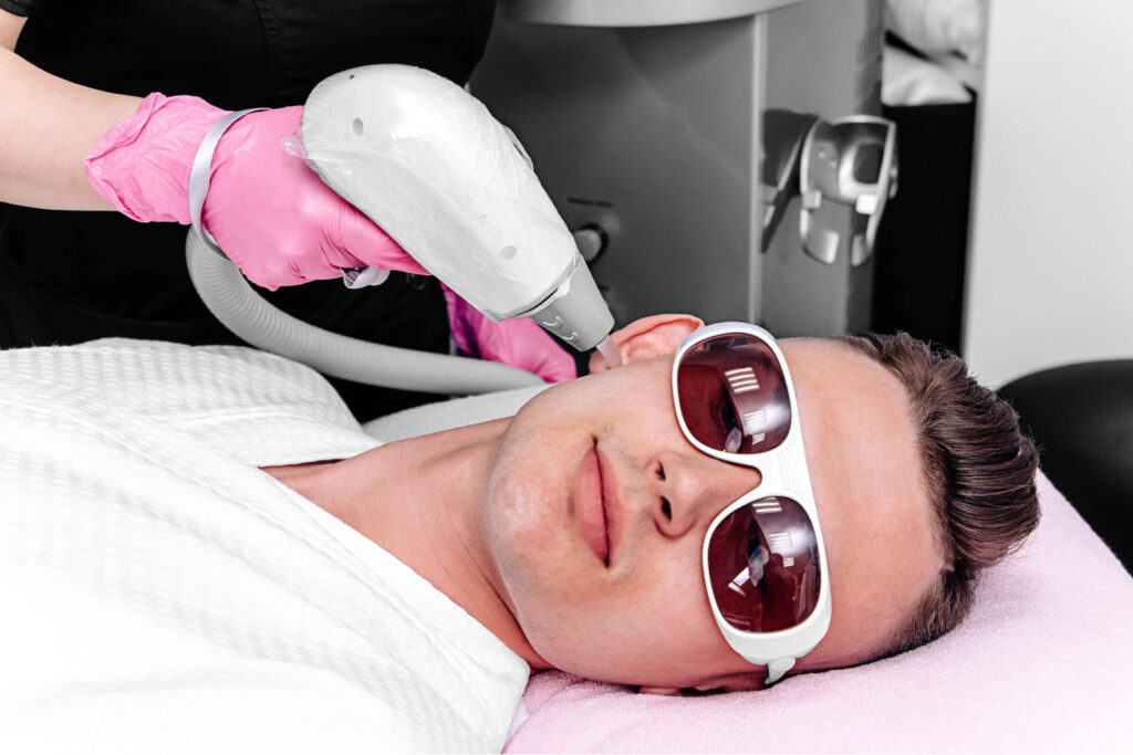 A Man with eyeglasses getting Side Burn Laser Hair Removal Treatment | Aspen Prime Med Spa in Hoboken, NJ